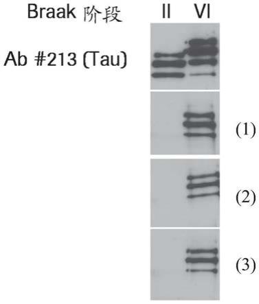 人源化的抗-Tau(pS422)抗体和使用方法与流程