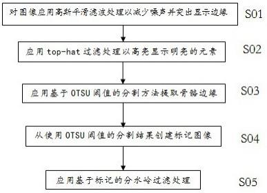 用于骨骼表面提取与自动分割的图像处理方法与系统与流程