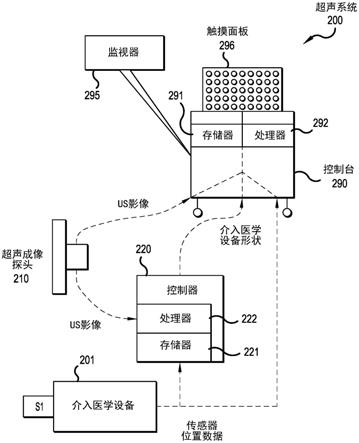 用于基于图像的设备分割的基于被动超声传感器的初始化的制作方法