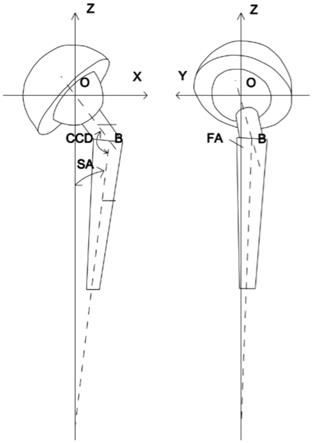 一种可进行假体姿态测量的全髋关节置换术测量系统的制作方法