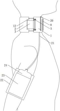 一种甲状腺术后引流固定装置的制作方法