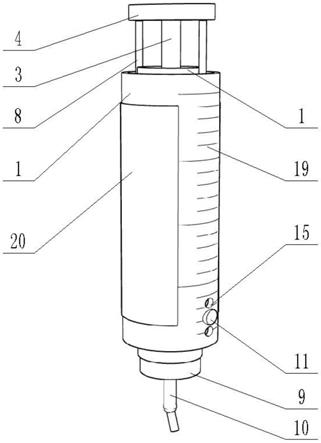 一种流食灌注器