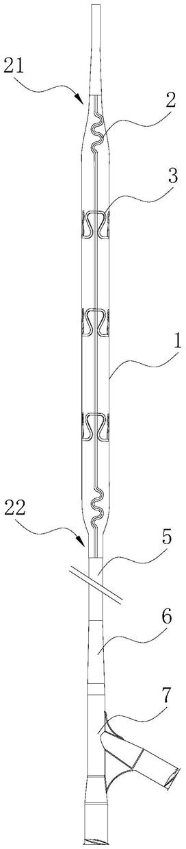 刻痕丝球囊及刻痕丝球囊扩张导管装置的制作方法