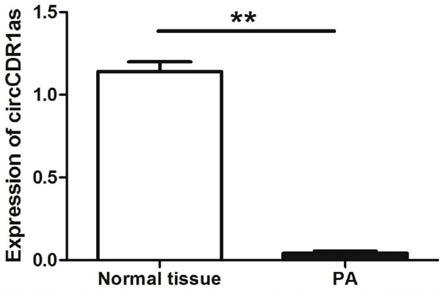一种检测CircCDR1as基因或蛋白的产品及应用