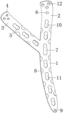 一种肱骨远端解剖锁定钢板的制作方法