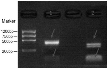 一种基于克隆和一代测序鉴定BCOR基因15号外显子串联重复的方法与流程