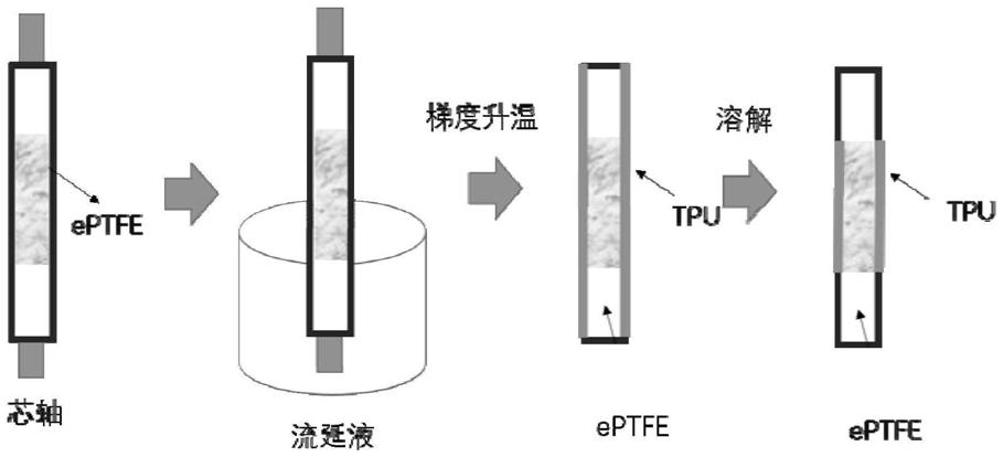 覆膜支架及其制备方法与流程