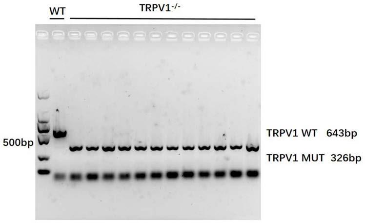 TRPV1在筛选或制备预防、缓解和/或治疗肝脏疾病的药物中的应用的制作方法