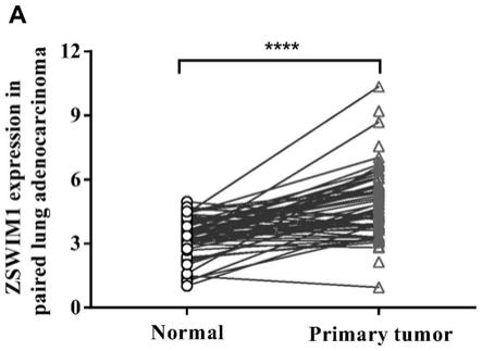 ZSWIM1蛋白在调控肺腺癌细胞增殖和转移中的应用