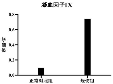 尿液凝血因子IX及其多肽片段在烧伤中的应用的制作方法