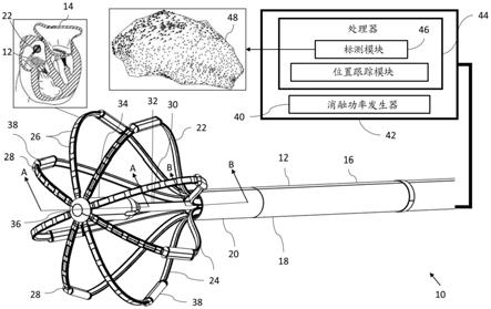 柔性电路和表面安装的电极导管的制作方法