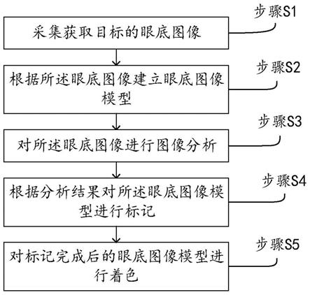 基于眼底影像的图像处理方法