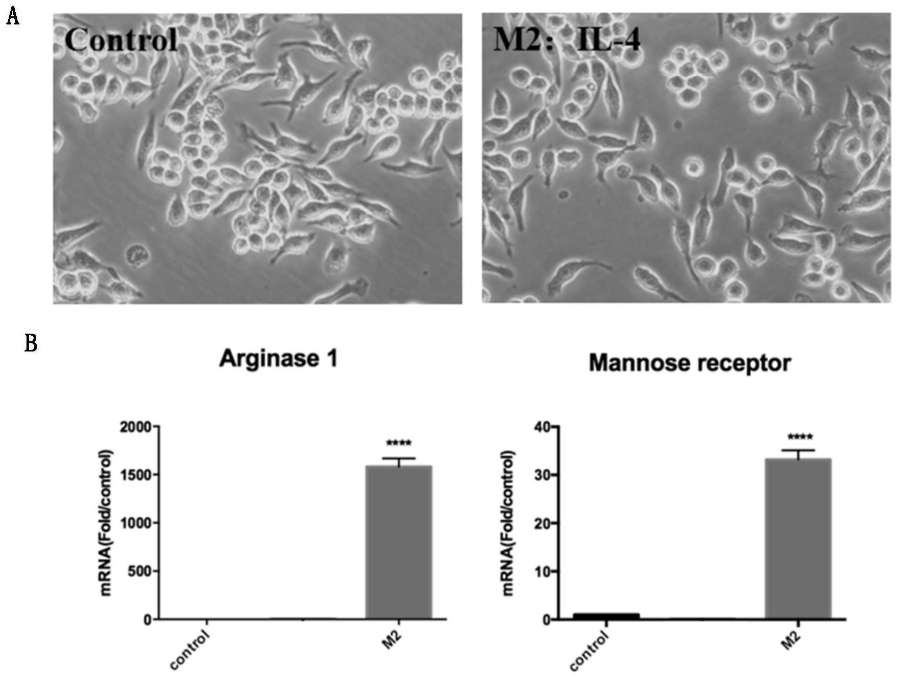M2型巨噬细胞外泌体在治疗骨质疏松症药物制备中的应用