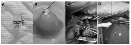 一种改良的静脉内衬支架大鼠原位肝移植模型建立方法