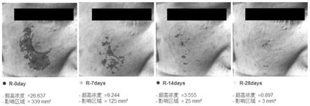 一种抗敏组合物及其制备方法与应用与流程