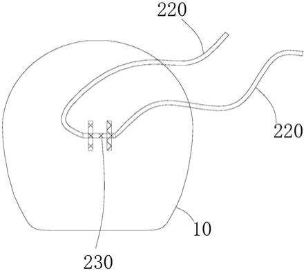 假体防护装置以及组合假体的制作方法