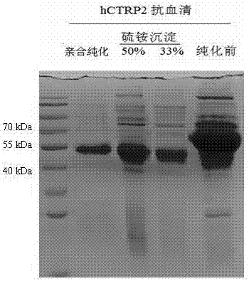 一种人补体C1q/TNFα相关蛋白‑2（hCTRP2）的抗原肽及其抗体的制作方法与工艺