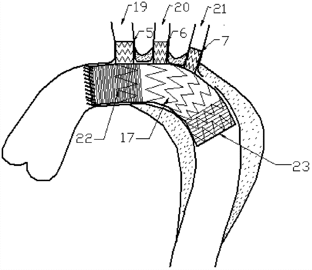 主動(dòng)脈弓術(shù)中支架及該支架的制造方法與流程