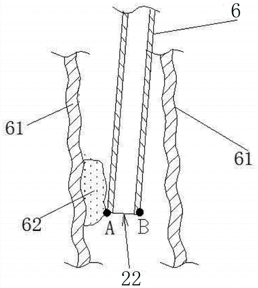 一種手動(dòng)吸痰器的制作方法與工藝