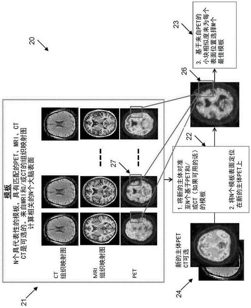 用于评估医学图像的方法和设备与流程