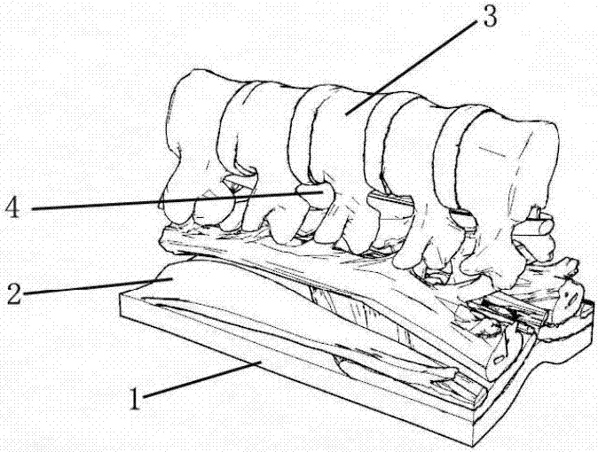 一種腰椎穿刺模型的製作方法