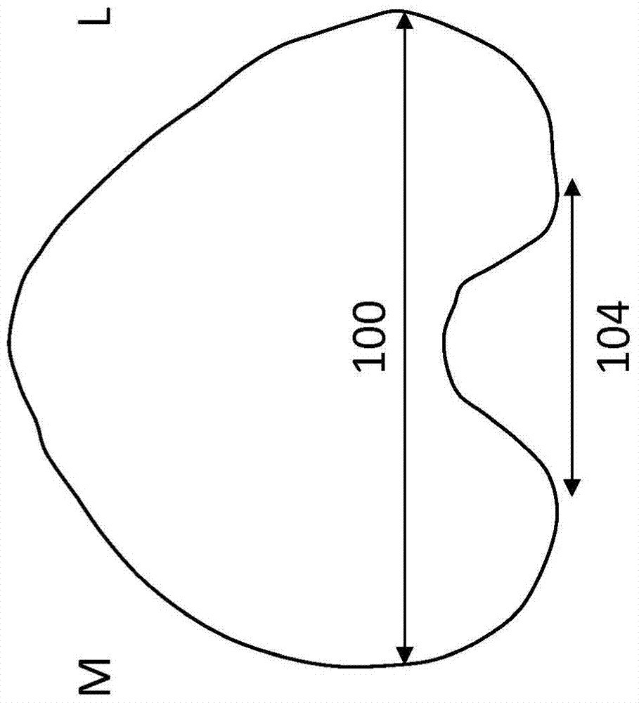 改進的適合患者型關(guān)節(jié)植入物以及處理、評估、校正、修改和/或適應解剖變化和/或非對稱性的手術(shù)和工具的制作方法與工藝