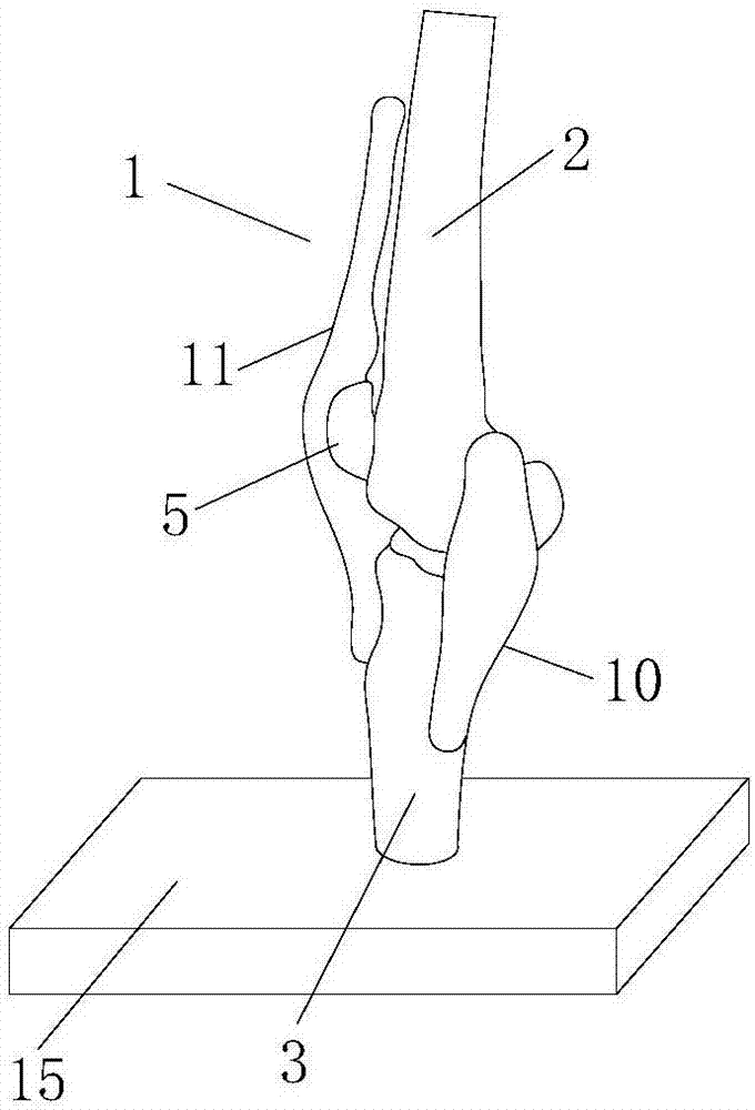 可拆卸膝关节教学模型的制作方法与工艺