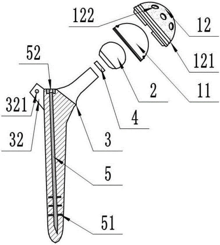 骨水泥型髖關(guān)節(jié)的制作方法與工藝