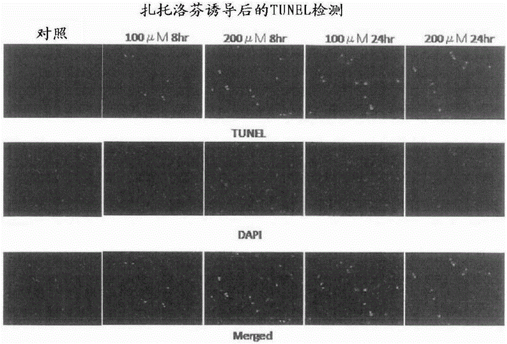 骨·軟組織中產(chǎn)生的巨細(xì)胞性腫瘤或軟骨肉瘤的預(yù)防或治療劑的制作方法與工藝