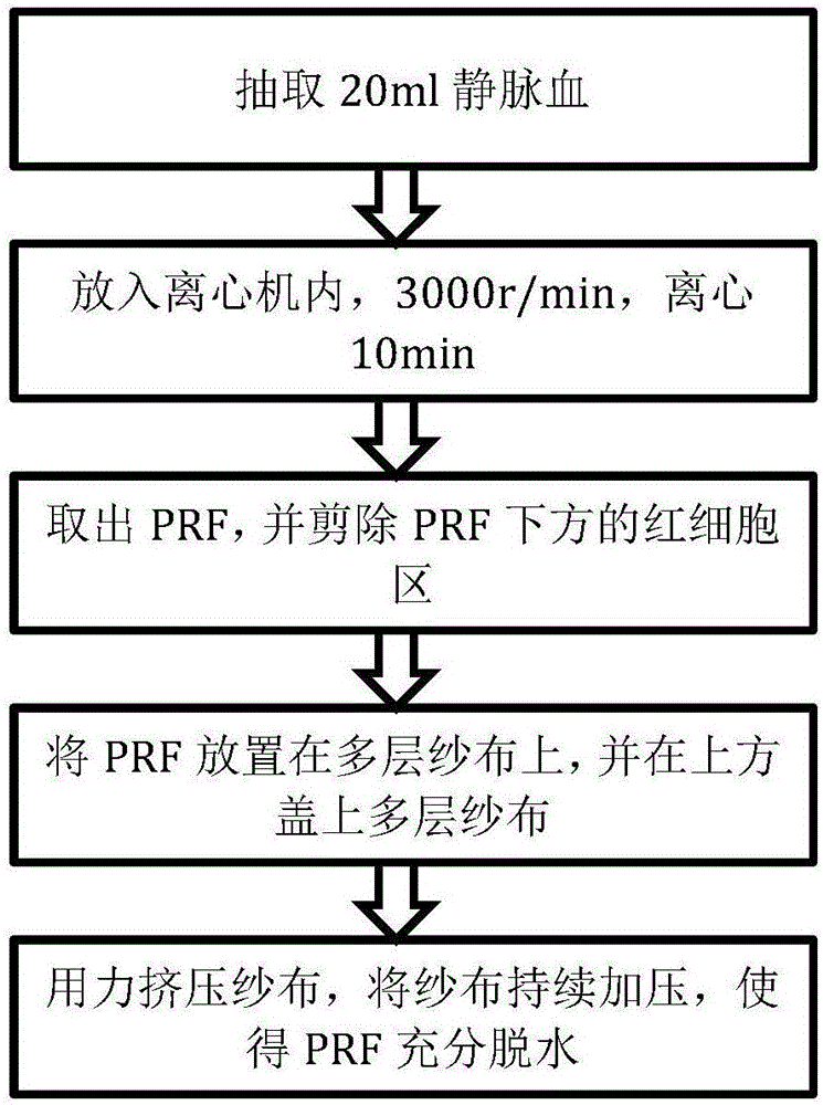 一种富血小板纤维蛋白膜的制备方法与流程