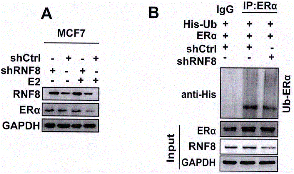 一種RNF8在促進乳腺癌方面的應(yīng)用的制作方法與工藝