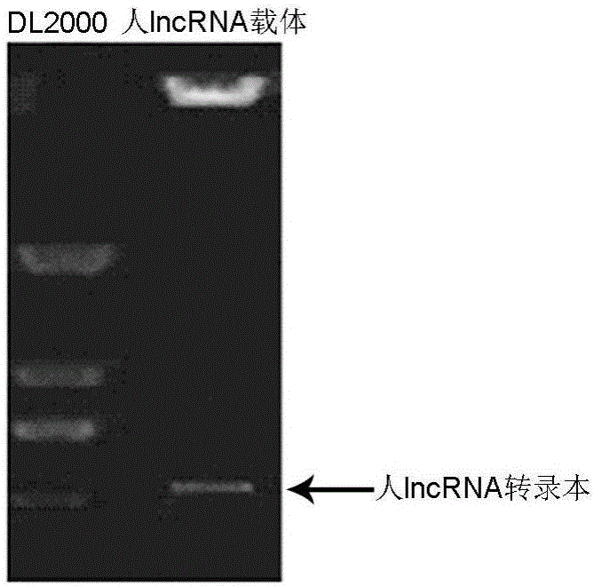 一種人lncRNA及其病毒載體在制備抑制真皮成纖維細(xì)胞膠原合成藥物中的應(yīng)用的制作方法與工藝