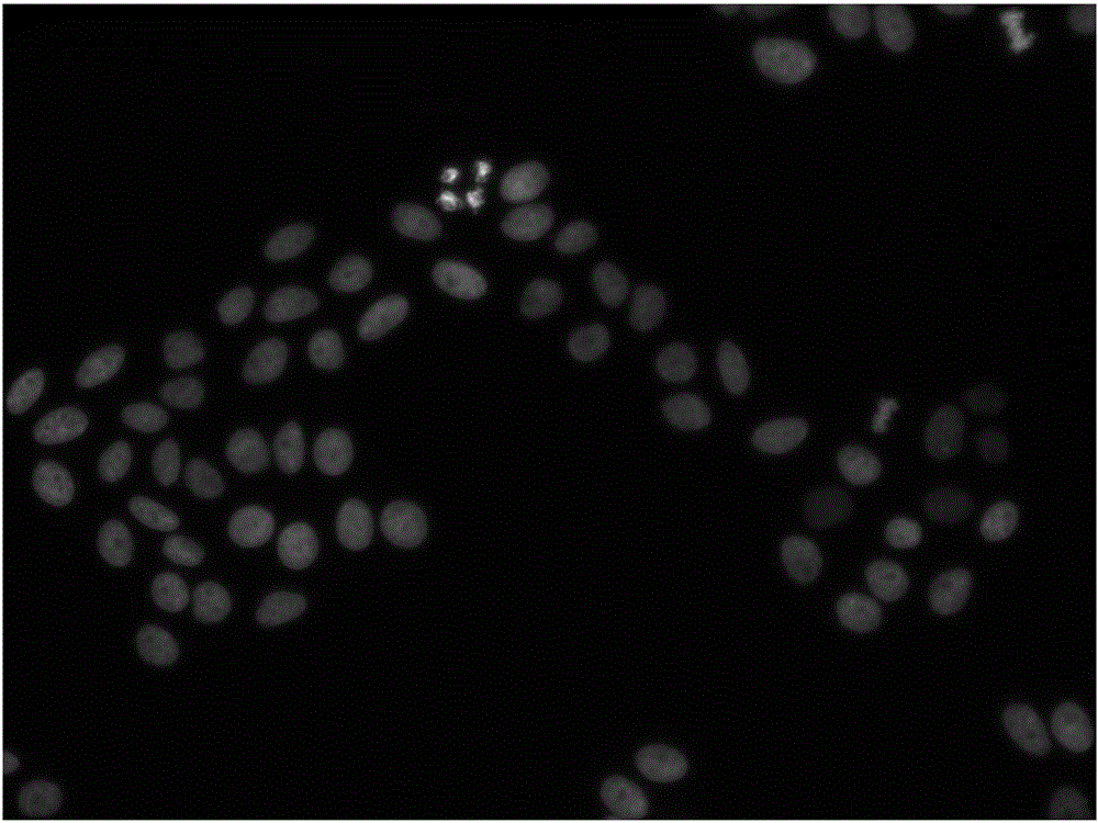 一种基于粒子群及模糊均值聚类的细胞图像分割方法与流程
