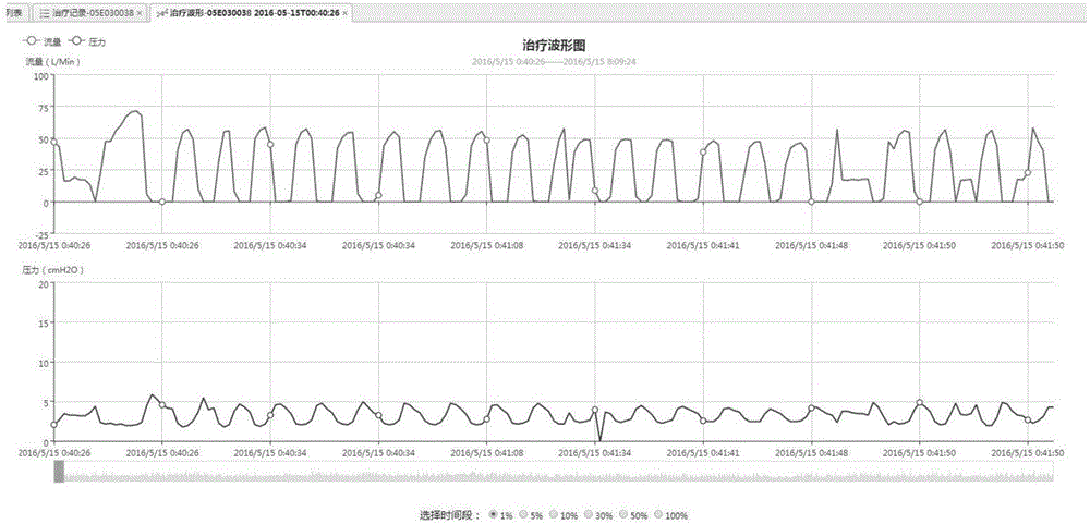 一种远程展示呼吸机历史治疗数据的波形图绘制方法与流程