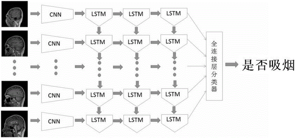 一種基于深度學(xué)習(xí)算法處理頭部結(jié)構(gòu)像數(shù)據(jù)的方法與流程