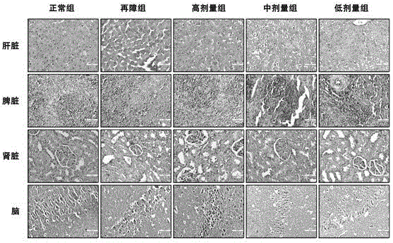 營養(yǎng)組合物及在制備器官損傷修復(fù)藥物中的應(yīng)用的制作方法與工藝