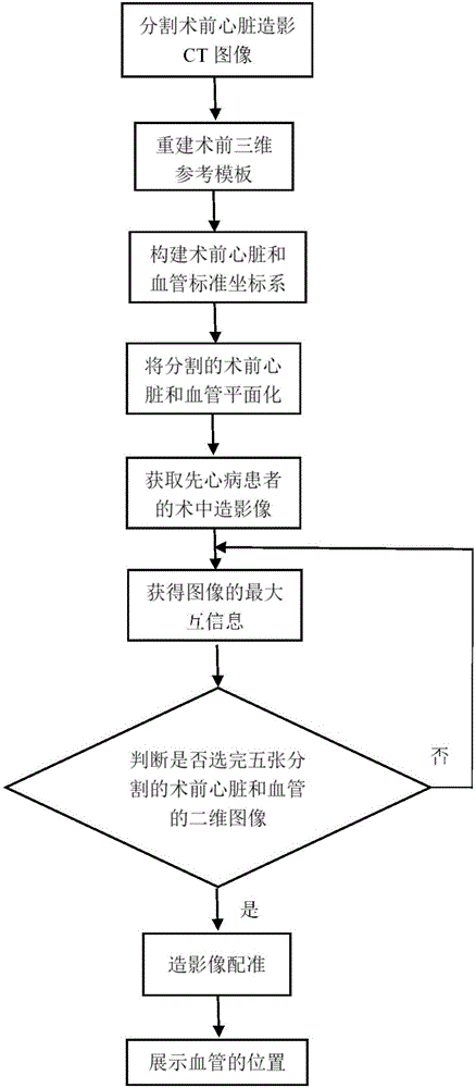 血管造影中介下先心病术中血管辨识的装置及方法与流程