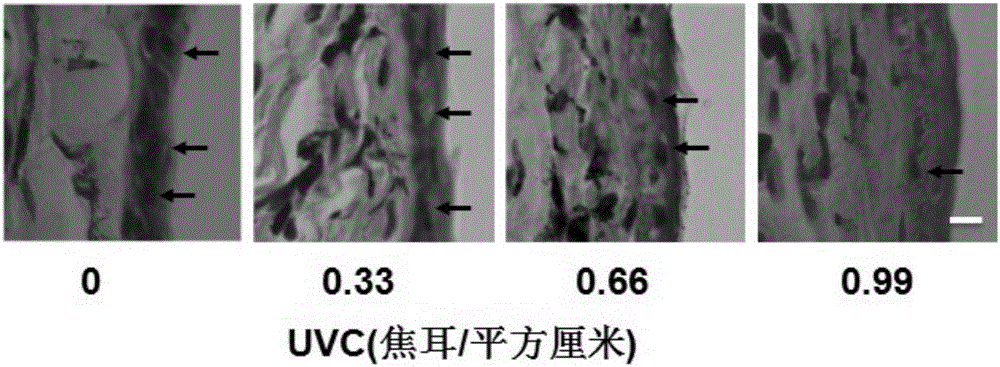 一種基于皮膚角質(zhì)層自發(fā)熒光無創(chuàng)預(yù)測(cè)紫外光誘導(dǎo)的皮膚損傷的方法與流程