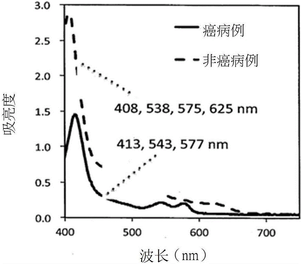 用以判斷子宮內(nèi)膜異位性卵巢囊腫致癌可能性之資料取得方法及其診斷裝置與流程