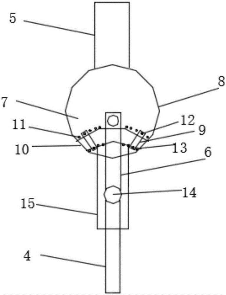 一种髋关节固定器的制作方法与工艺
