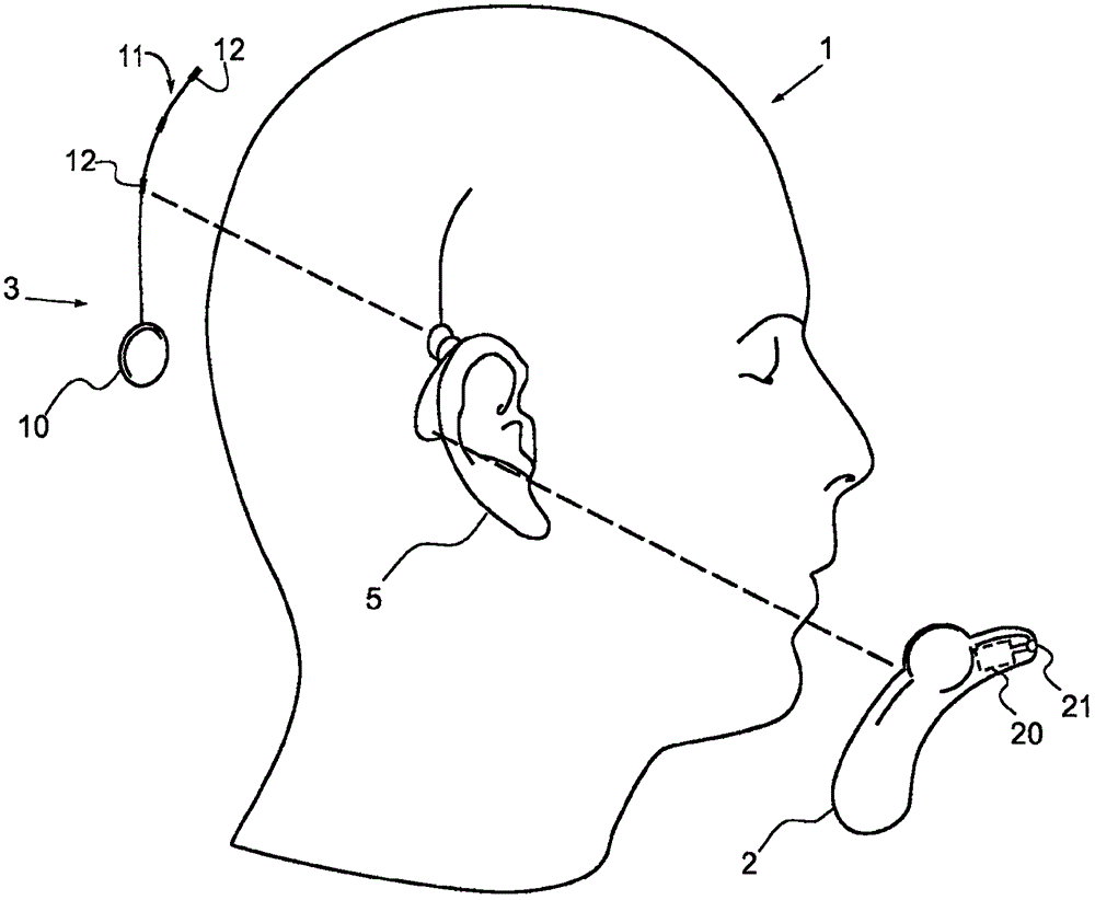 具有兩個揚聲器的生物電信號監(jiān)控器的制作方法與工藝