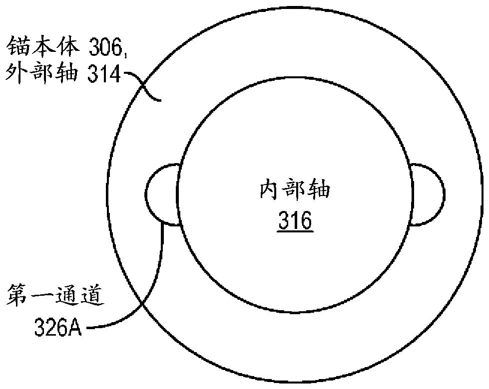 兩部件式無結縫線錨的制作方法與工藝