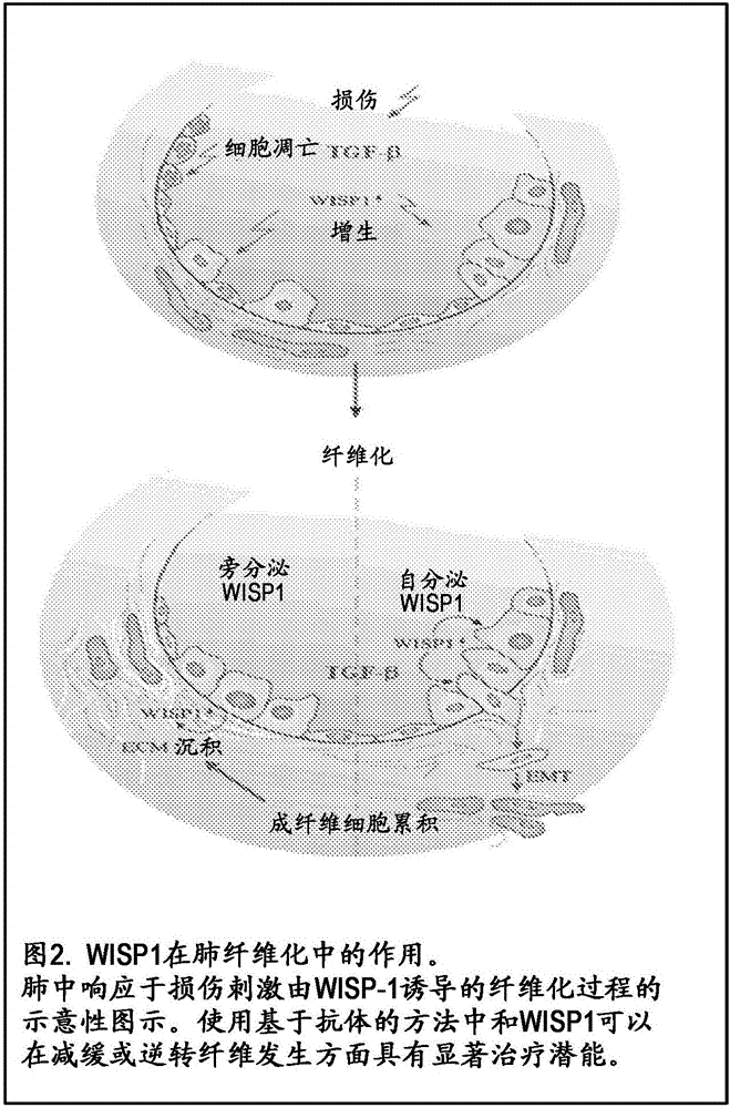 结合WISP1的抗体疗法的制作方法与工艺