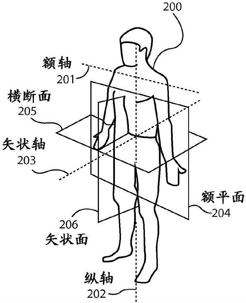 至少部分地基于腕式佩戴装置的倾斜的操作的执行的制作方法