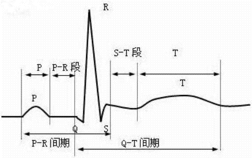 心电图R波定义图片