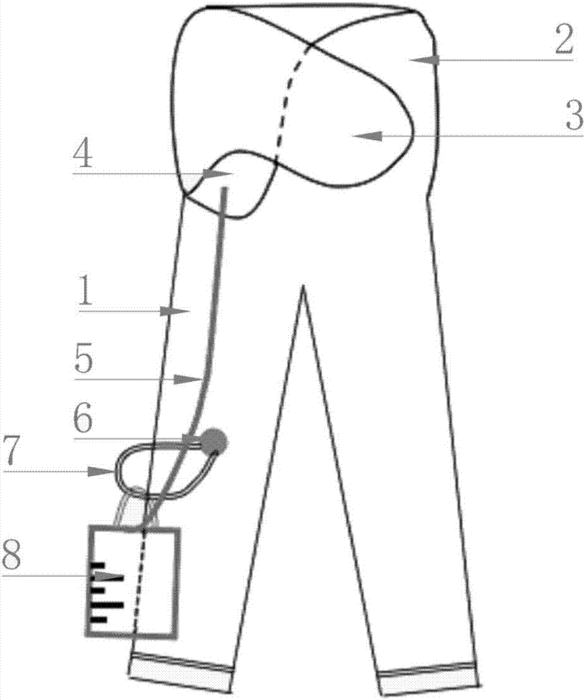 阑尾切除术后留置腹腔管患者用病号裤的制造方法与工艺