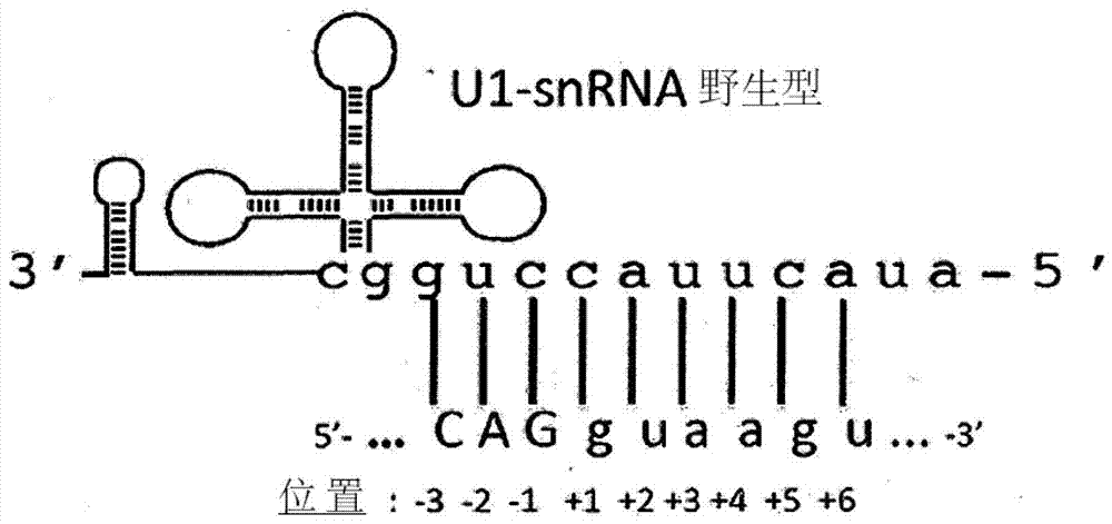 修饰的人类U1snRNA分子、编码修饰的人类U1snRNA分子的基因、包括该基因的表达载体及其在基因治疗中的用途的制造方法与工艺