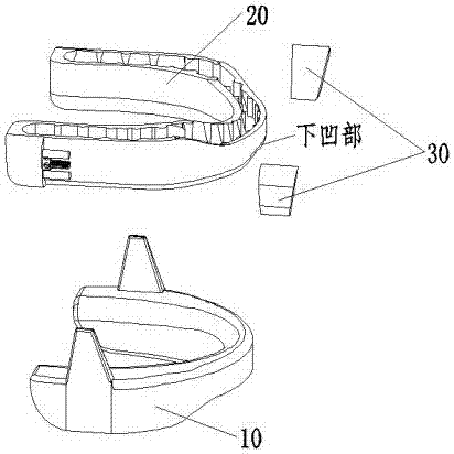 阻鼾器制作步骤图片