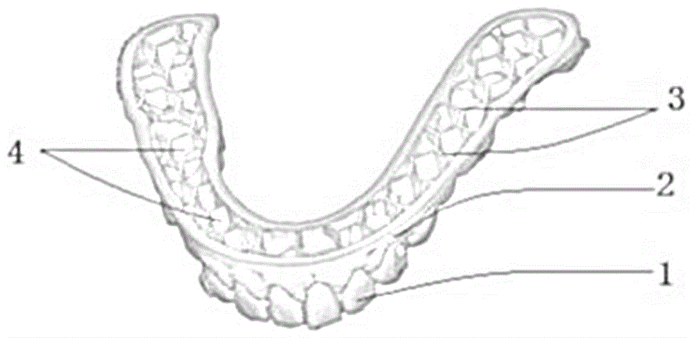蜂窝状牙颌模型的制造方法与工艺