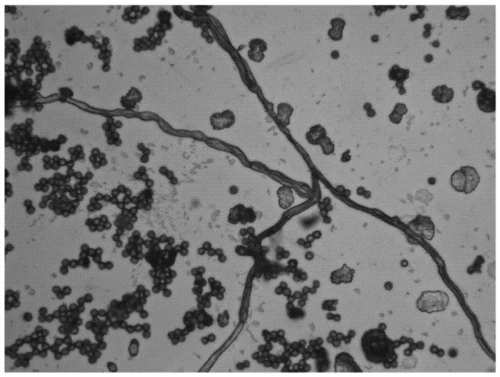 黑曲霉菌结构图片